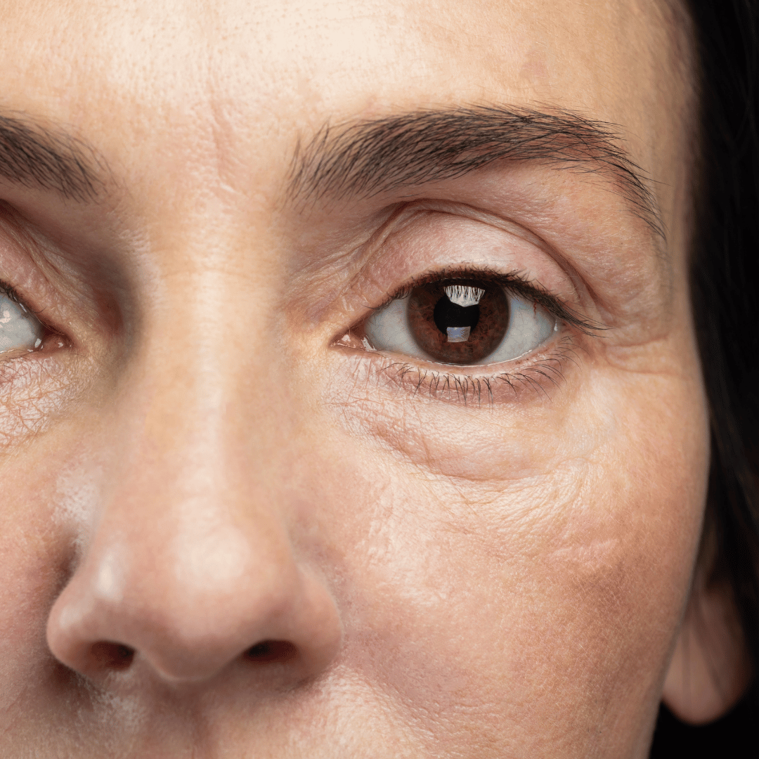 Dull Skin