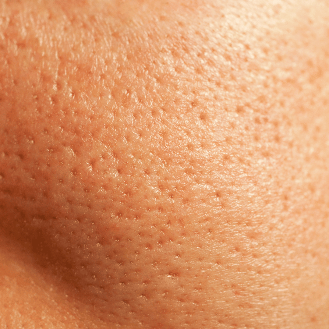 Visible Pores